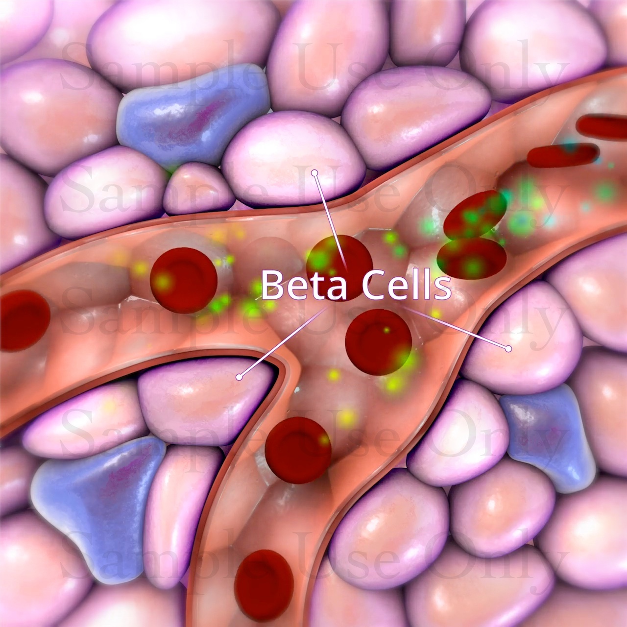 Medical Illustration Sample: Pancreatic Beta Cells