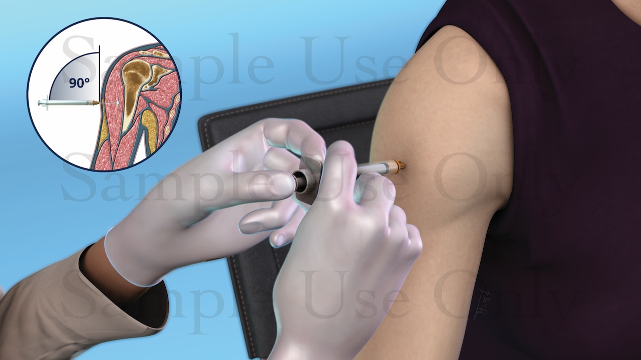 Medical Illustration Sample: Proper Injection Technique