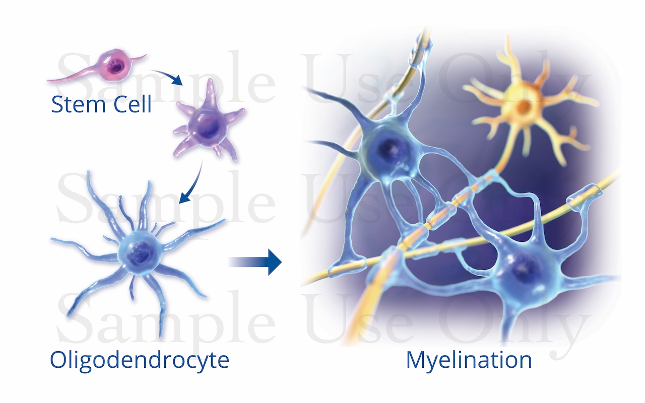 Medical Illustration Sample: Stem Cell Myelination