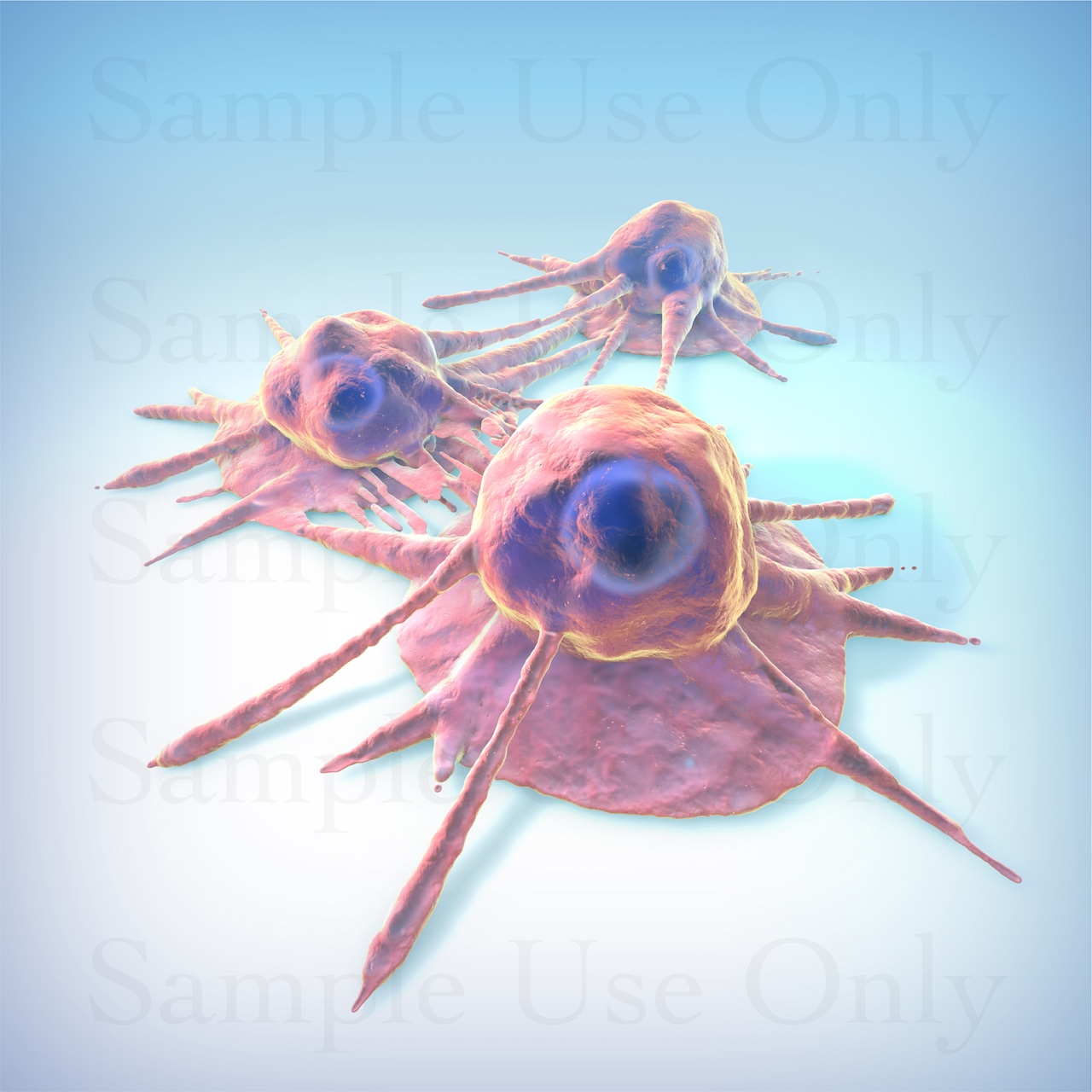 Medical Illustration Sample: Cancer Cells Multiplying